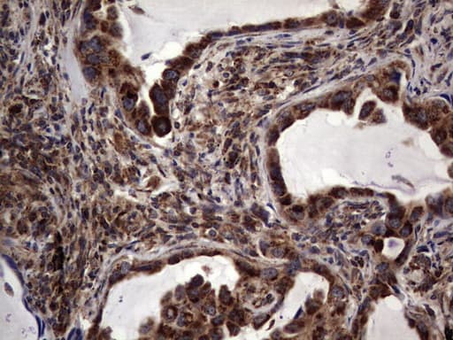DOCK8 Antibody (aa832-1160, clone OTI4H10)