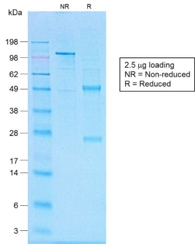Recombinant Monoclonal Rabbit anti-Human CD20 Antibody (clone IGEL/1497R, Azide-free,Carrier-free, IHC)