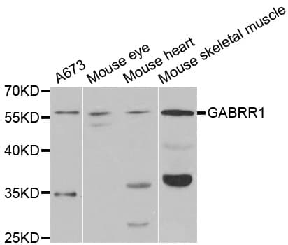 GABRR1 / GABA(A) Receptor rho- Antibody