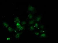 NNMT Antibody (clone OTI1A1)