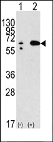 BECN1 / Beclin-1 Antibody (aa210-239)