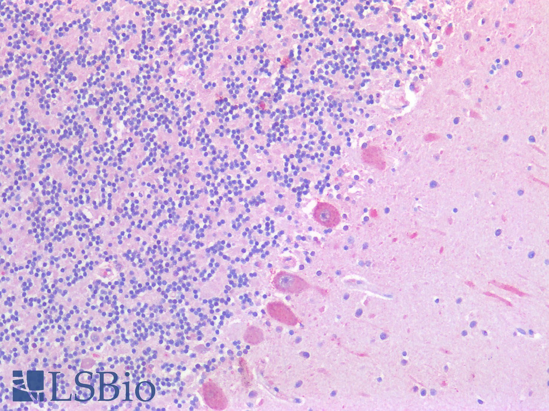 PathPlus™ SLC6A8 Antibody (aa212-226)