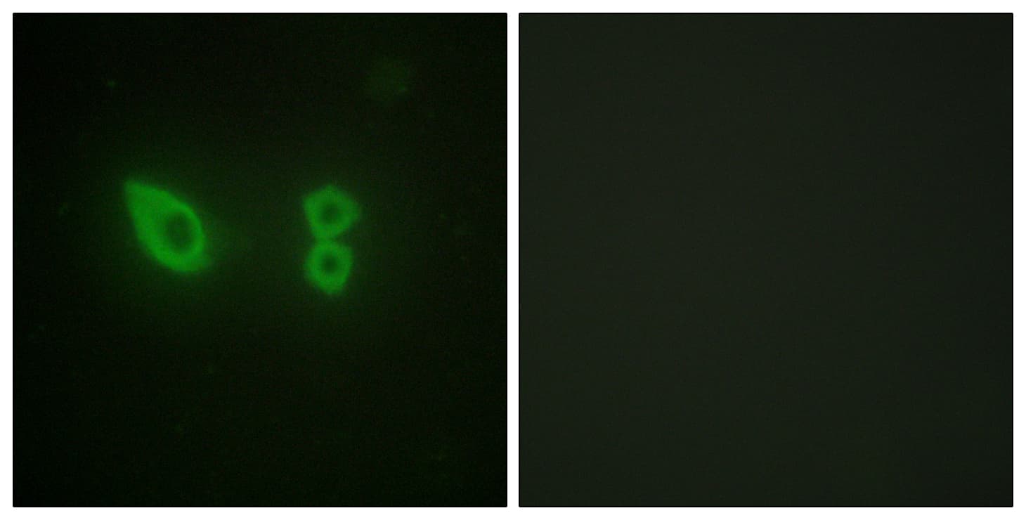 Polyclonal Rabbit anti-Human Actinin-Alpha 2+3 Antibody (N-Terminus, IHC, IF, WB)