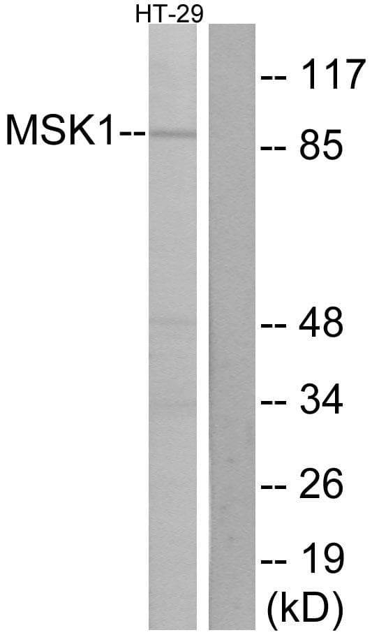RPS6KA5 / MSK1 Antibody (p376)