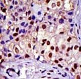 RAD23A / HHR23A Antibody (aa303-333)