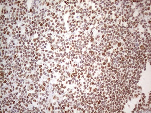HNRNPL / hnRNP L Antibody (aa270-502, clone OTI4E5, Carrier-free)