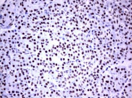 Monoclonal Mouse anti-Human FOXP1 Antibody (clone OTI3G3, IHC)
