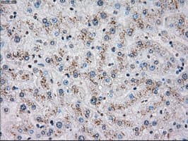 Monoclonal Mouse anti-Human CHEK2 / CHK2 Antibody (clone OTI5C7, IHC, WB)