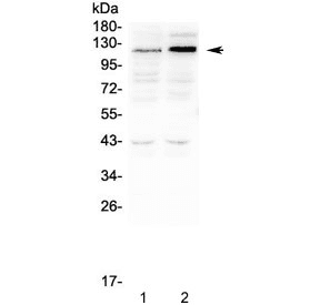 SLC34A2 / NaPi-2b Antibody