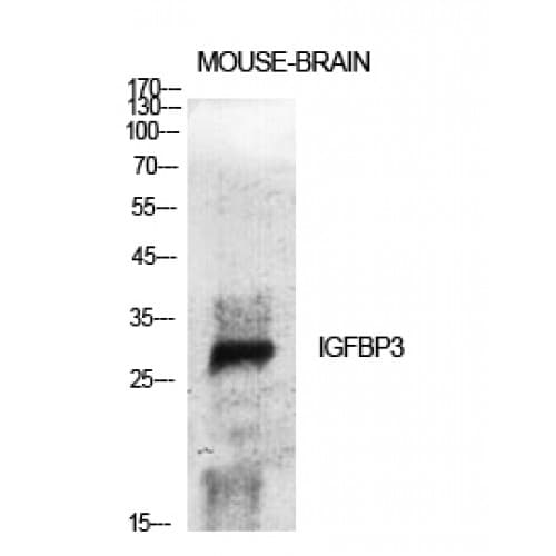 Polyclonal Rabbit anti-Human IGFBP3 Antibody (120-200 aa, IHC, WB)