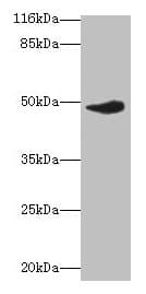 Polyclonal Rabbit anti-Human ICSBP / IRF8 Antibody (aa1-424, WB)