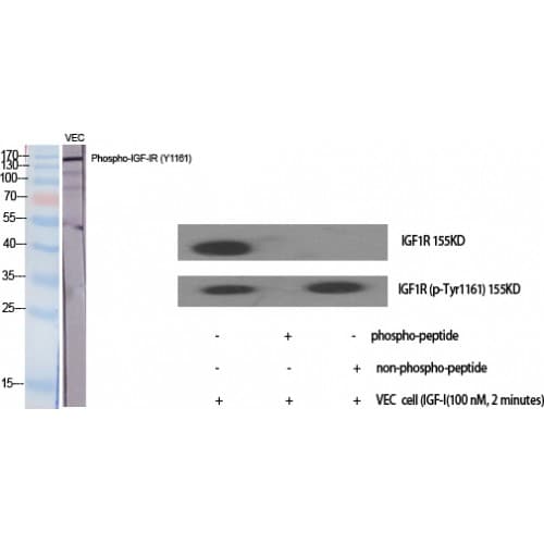 Polyclonal Rabbit anti-Human IGF1R / IGF1 Receptor Antibody (1100-1180 aa, IHC, WB)
