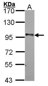 BRAF / B-Raf Antibody