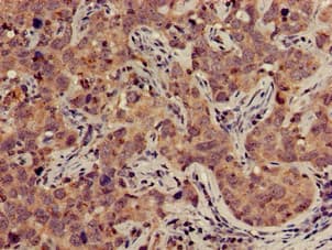 TFB2M Antibody