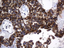 TAPBPL / TAPBPR Antibody (clone OTI5E5)