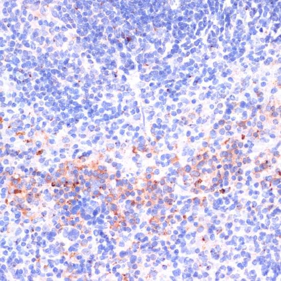 PRF1 / Perforin Antibody
