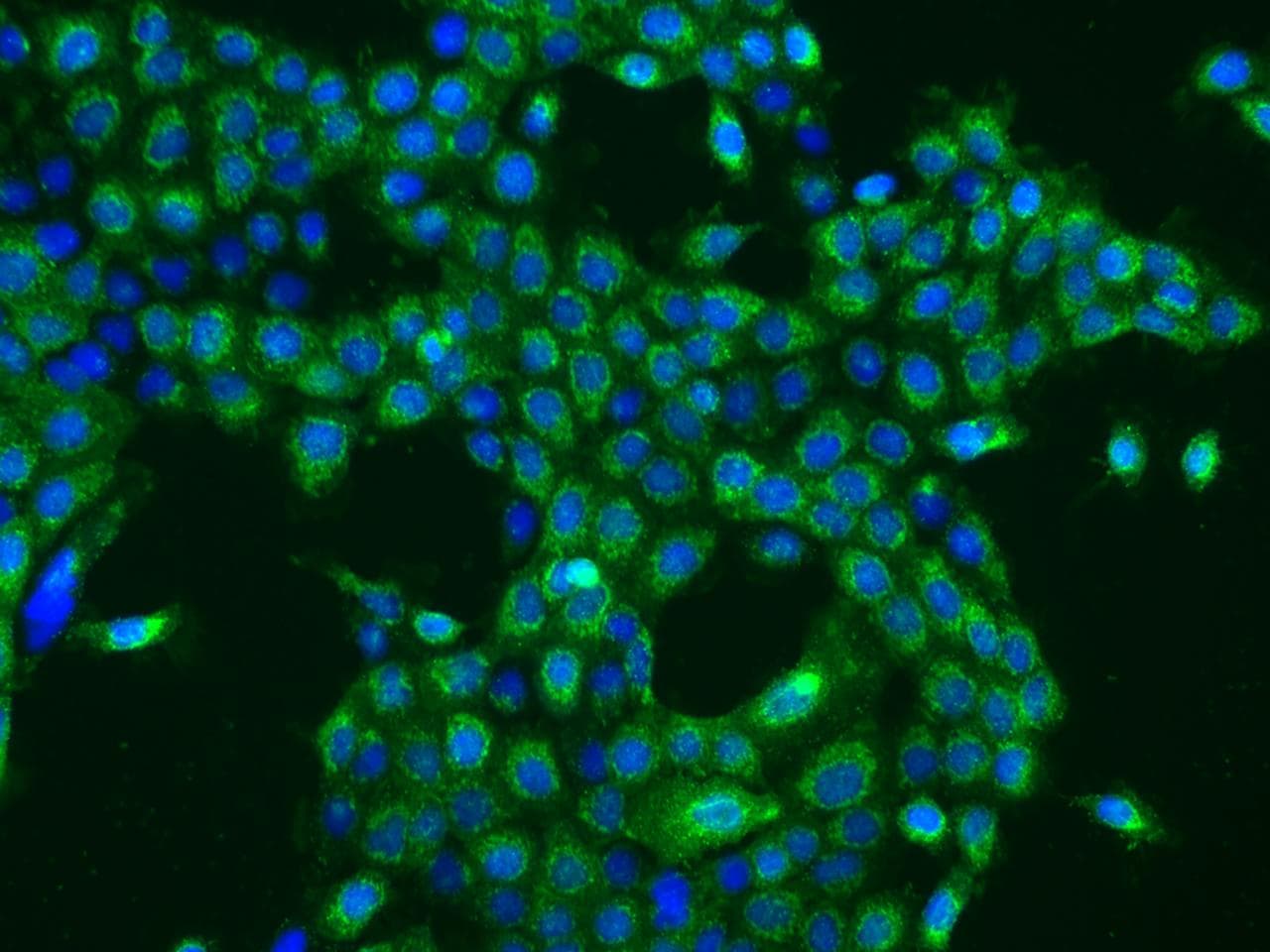 OXA1L / OXA1 Antibody