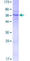 Human SH3YL1 Protein (Recombinant GST)