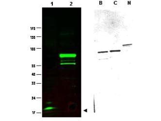 IHC-plus™ Polyclonal Rabbit anti-Human SPANXC / SPANX-C Antibody (IHC, WB)