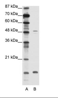 FBN1 / Fibrillin 1 Antibody (N-Terminus)