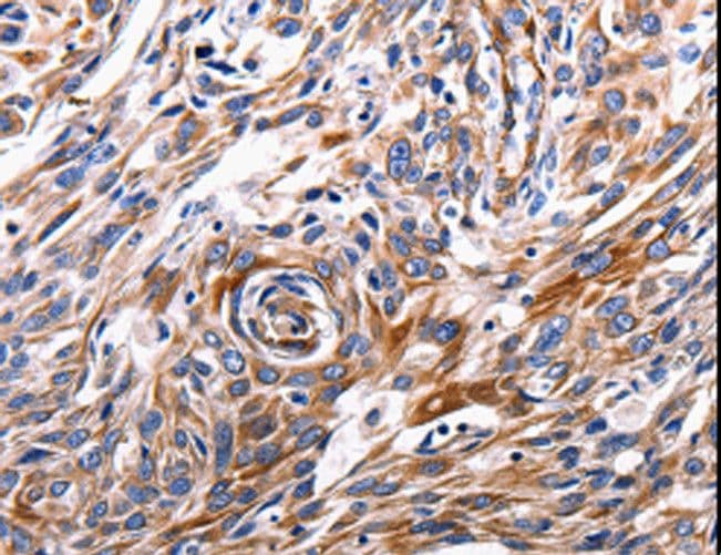 Polyclonal Rabbit anti-Human ACE2 / ACE-2 Antibody (IHC)