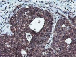 HDHD1 Antibody (clone OTI7A2)