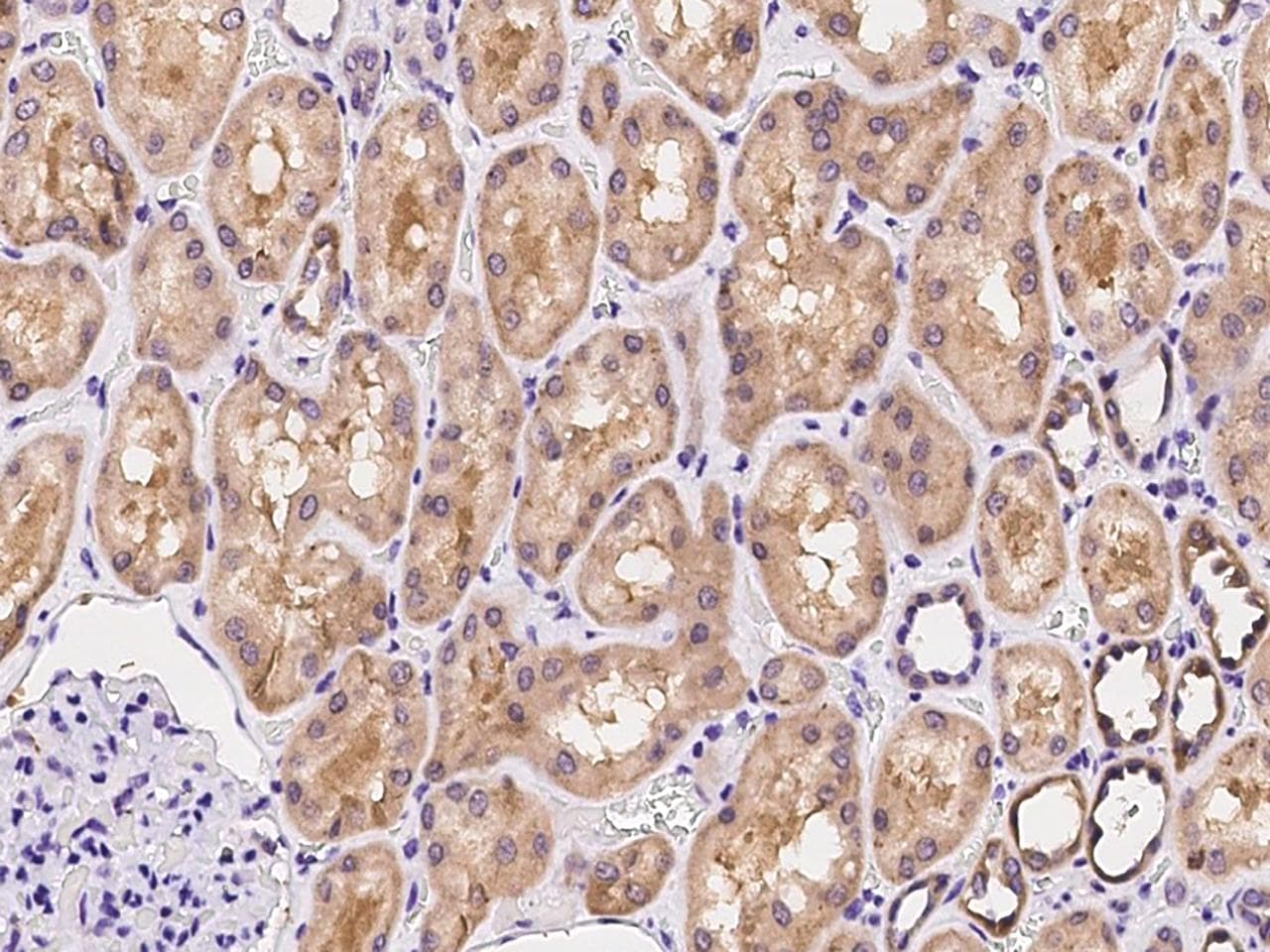 ARHGAP11A Antibody