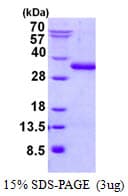 Human UBTD2 Protein (Recombinant His)