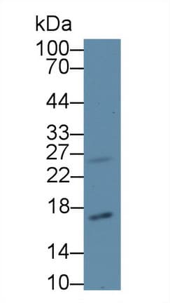 p16INK4a / CDKN2A Antibody (aa8-156)