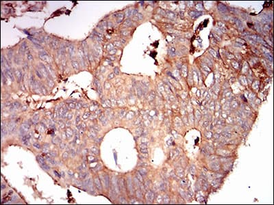 SDC1 / Syndecan 1 / CD138 Antibody (aa28-171, clone 1A3H4)