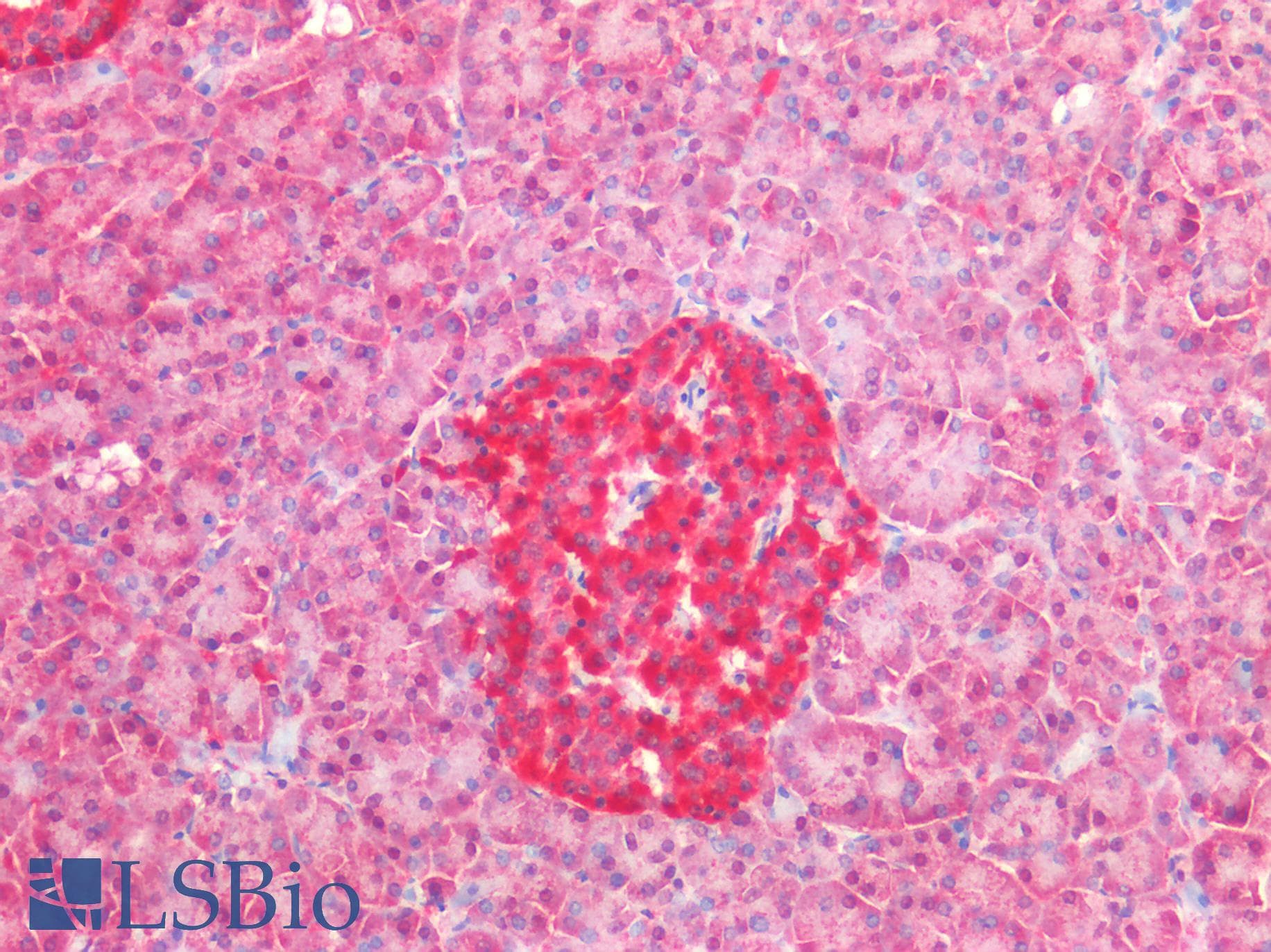 PathPlus™ BECN1 / Beclin-1 Antibody