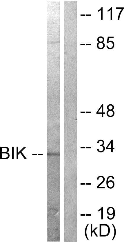 Polyclonal Rabbit anti-Human BIK Antibody (p33, IHC, IF, WB)