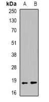 MECOM / EVI1 Antibody