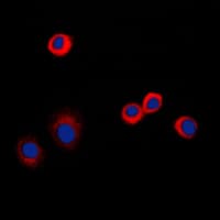 TNFRSF1B / TNFR2 Antibody (C-Terminus)