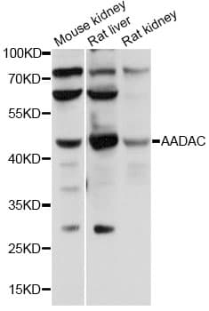 AADAC Antibody