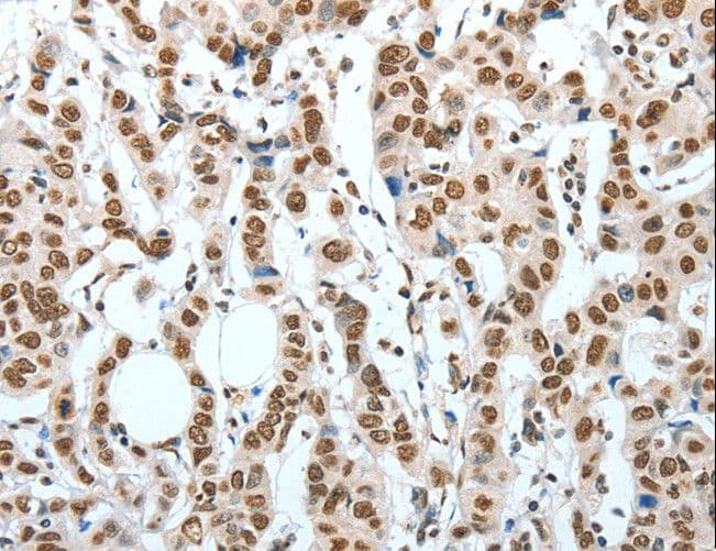 BNIP1 Antibody