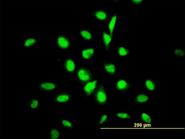 IHC-plus™ Monoclonal Mouse anti-Human YY1 Antibody (clone 4D2, IHC, IF, WB)