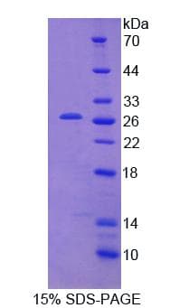 Mouse CAMLG / CAML Protein (Recombinant His-T7)