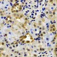 EPHX2 / Epoxide Hydrolase 2 Antibody