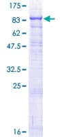 Human GALC / Galactocerebrosidase Protein (Recombinant GST)