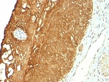 KRT19 / CK19 / Cytokeratin 19 Antibody (clone KRT19/800)