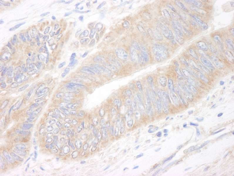 KIAA1524 / p90 Autoantigen Antibody (aa550-600)
