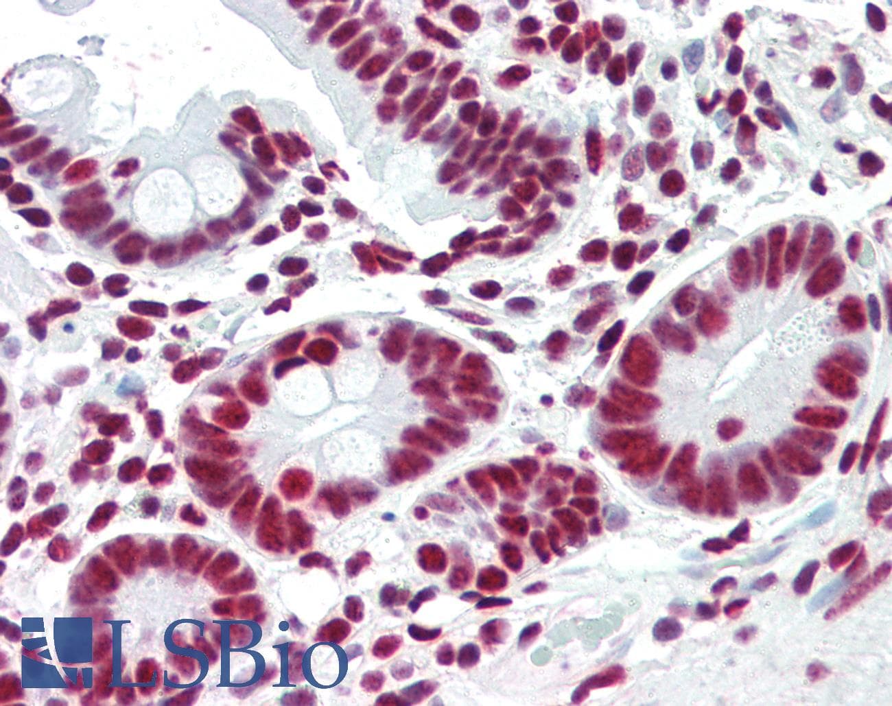 PathPlus™ ACIN1 / Acinus Antibody