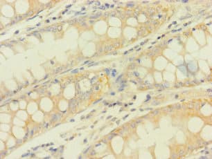 PDHA1 / PDH E1 Alpha Antibody