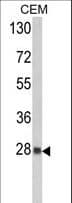 PRDX6 / Peroxiredoxin 6 Antibody (aa197-224)