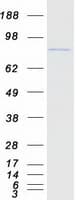 Human TP63 / p63 Protein (Recombinant Myc-DDK (Flag))
