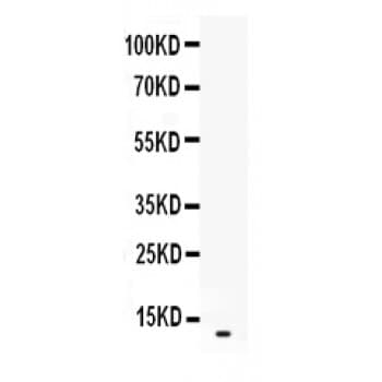 MIP2 / GRO2 / CXCL2 Antibody (aa32-100)