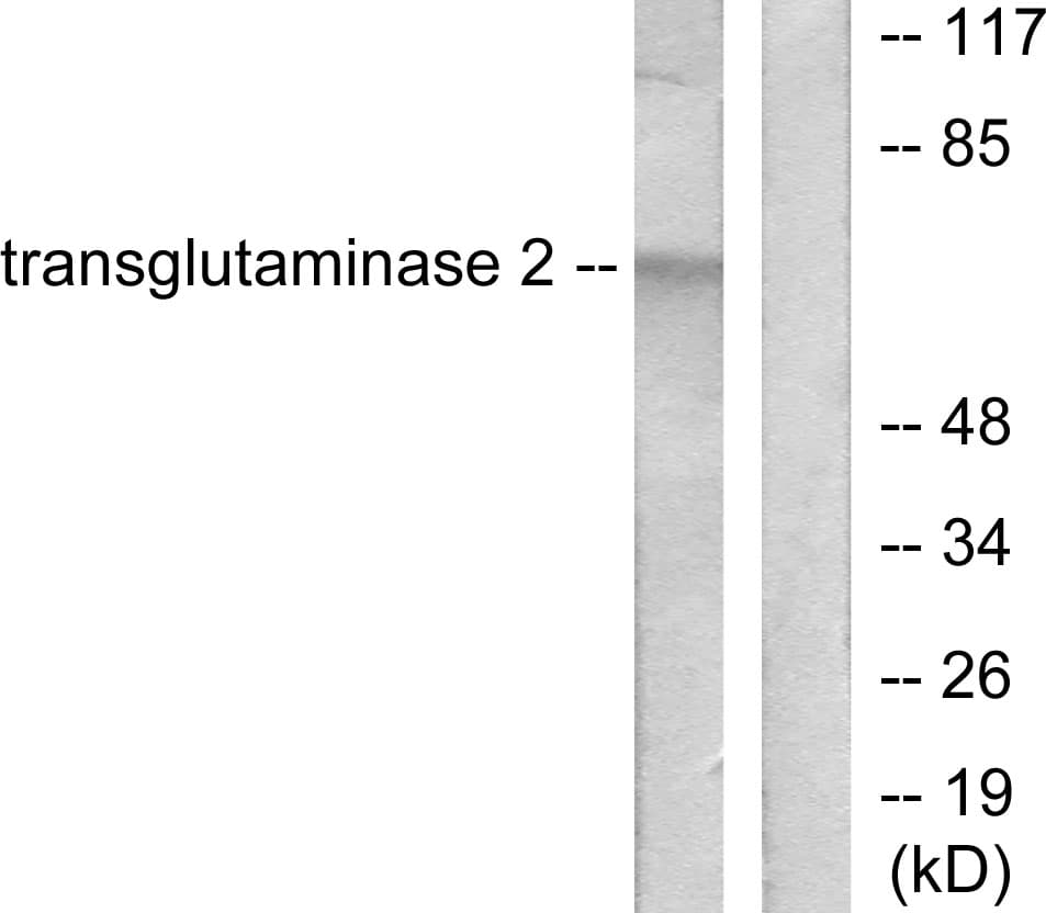 IHC-plus™ TGM2 / Transglutaminase 2 Antibody (aa1-50)