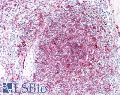 IHC-plus™ HLA-DRB1 Antibody (clone LN3)