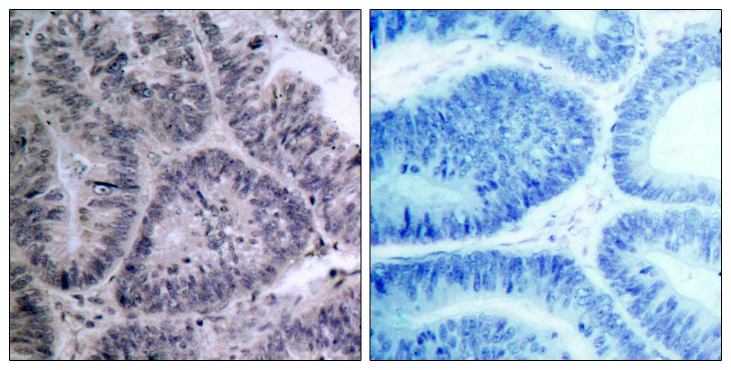 Polyclonal Rabbit anti-Human CHUK / IKKA / IKK Alpha Antibody (p23, IHC, WB)
